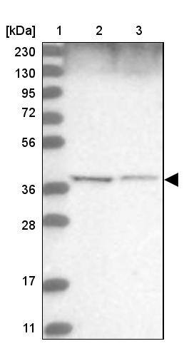 WDR92 Antibody - BSA Free Western Blot: WDR92 Antibody - BSA Free [NBP1-92595]