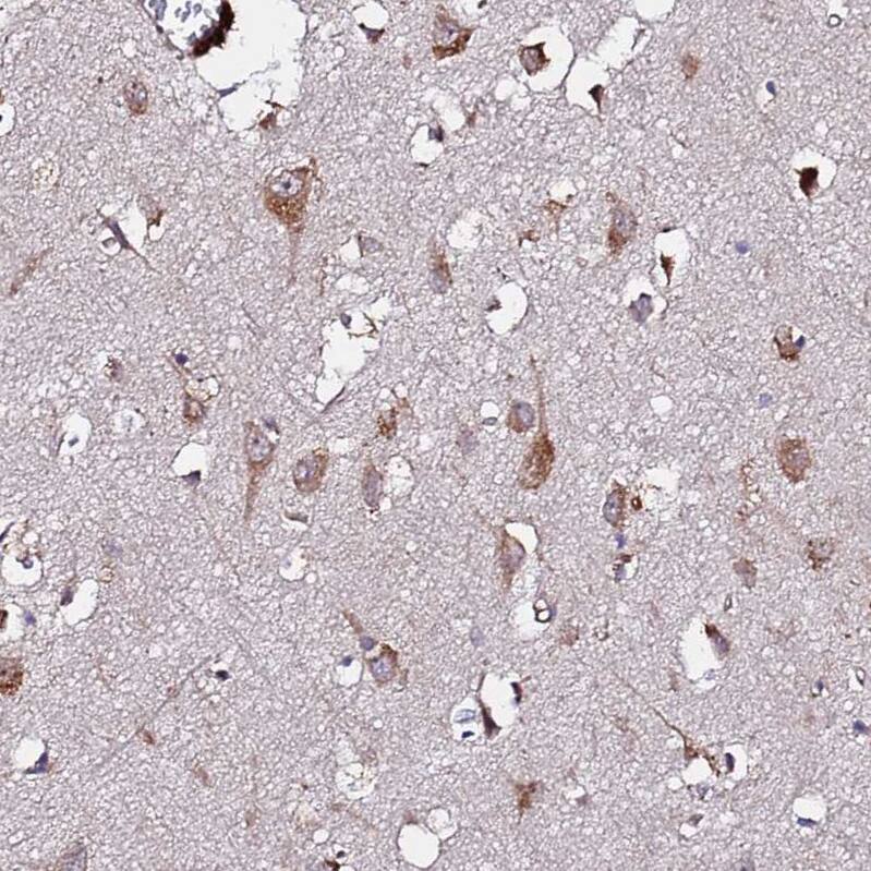 WWC2 Antibody - BSA Free Immunohistochemistry: WWC2 Antibody - BSA Free [NBP1-92598]