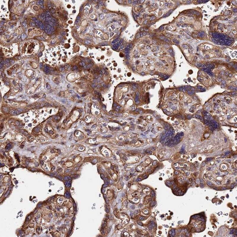 WWC2 Antibody - BSA Free Immunohistochemistry: WWC2 Antibody - BSA Free [NBP1-92598]