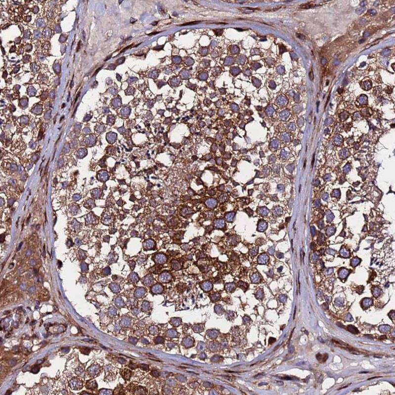 WWC2 Antibody - BSA Free Immunohistochemistry: WWC2 Antibody - BSA Free [NBP1-92598]