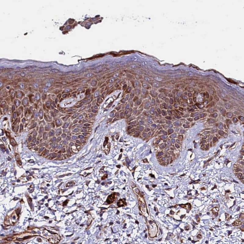 WWC2 Antibody - BSA Free Immunohistochemistry: WWC2 Antibody - BSA Free [NBP1-92598]
