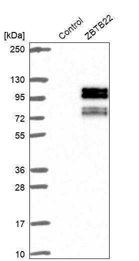 ZBTB22 Antibody - BSA Free Western Blot: ZBTB22 Antibody - BSA Free [NBP1-92603]