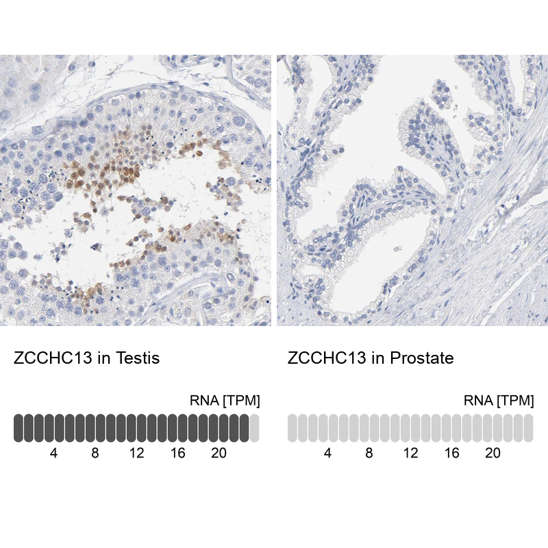 ZCCHC13 Antibody - BSA Free Immunohistochemistry: ZCCHC13 Antibody - BSA Free [NBP1-92604]
