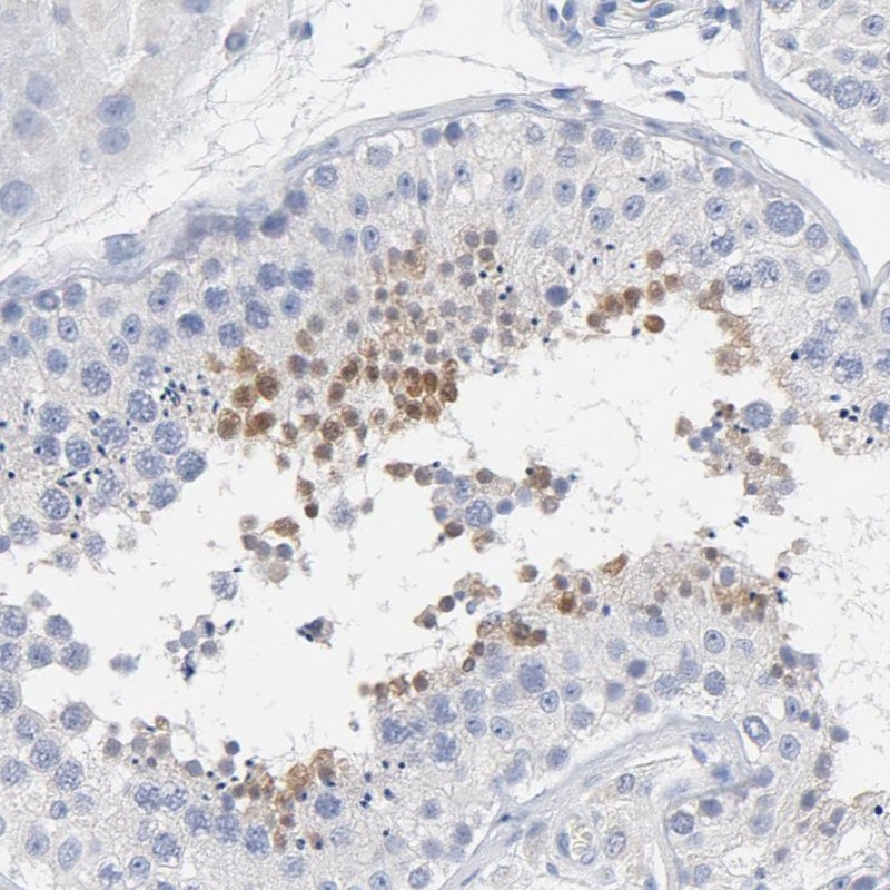 ZCCHC13 Antibody - BSA Free Immunohistochemistry: ZCCHC13 Antibody - BSA Free [NBP1-92604]