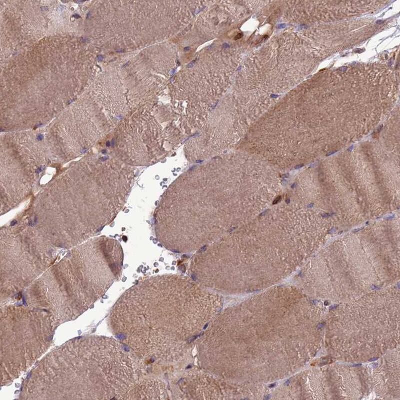 ZCCHV Antibody - BSA Free Immunohistochemistry: ZCCHV Antibody - BSA Free [NBP1-92607]
