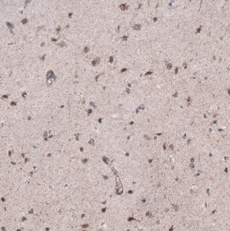 ZDHHC14 Antibody - BSA Free Immunohistochemistry: ZDHHC14 Antibody - BSA Free [NBP1-92608]