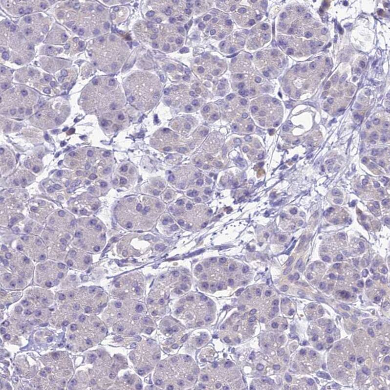 ZMIZ1/Zimp10 Antibody - BSA Free Immunohistochemistry: ZMIZ1/Zimp10 Antibody - BSA Free [NBP1-92610]