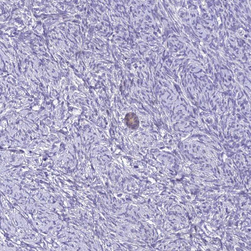 ZMIZ1/Zimp10 Antibody - BSA Free Immunohistochemistry: ZMIZ1/Zimp10 Antibody - BSA Free [NBP1-92610]