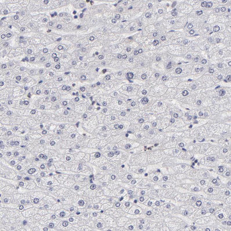 Zinc finger protein 773 Antibody - BSA Free Immunohistochemistry: Zinc finger protein 773 Antibody - BSA Free [NBP1-92616]