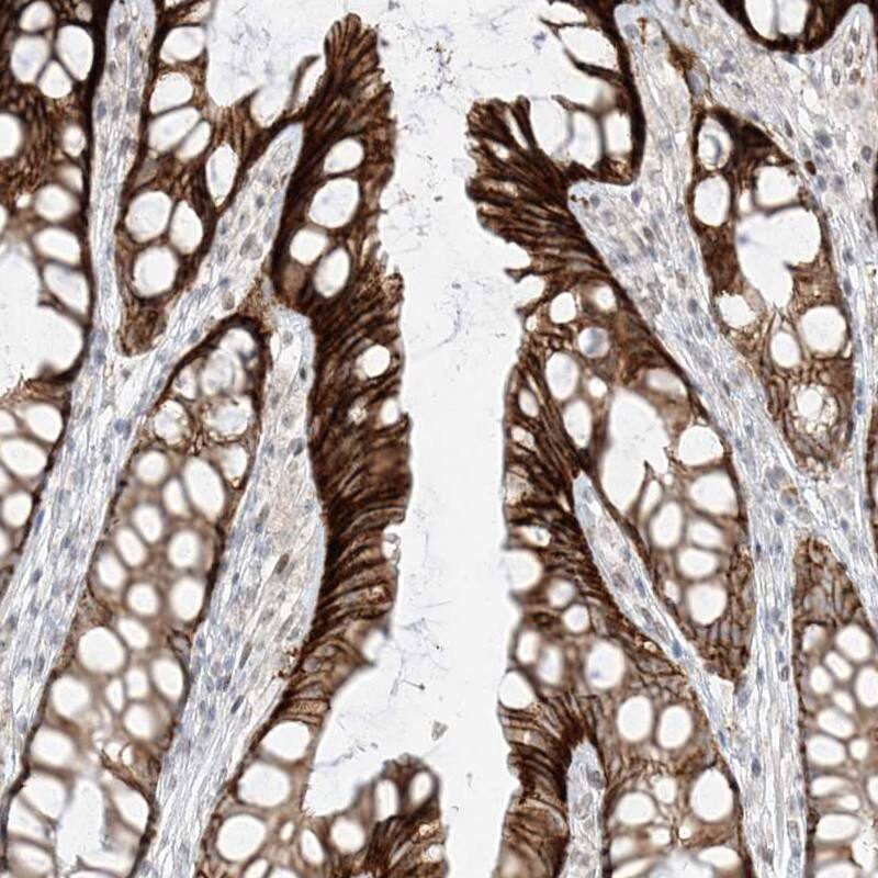 Zinc finger protein 774 Antibody - BSA Free Immunohistochemistry-Paraffin: Zinc finger protein 774 Antibody [NBP1-92617]