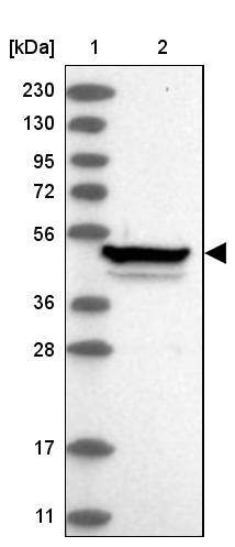 Zinc finger protein 774 Antibody - BSA Free Western Blot: Zinc finger protein 774 Antibody - BSA Free [NBP1-92617]