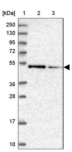 ZNF181 Antibody - BSA Free Western Blot: ZNF181 Antibody - BSA Free [NBP1-92618]