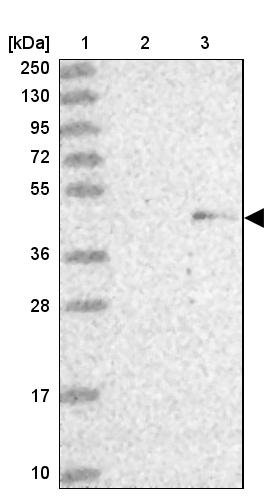 ZNF239 Antibody - BSA Free Western Blot: ZNF239 Antibody - BSA Free [NBP1-92620]