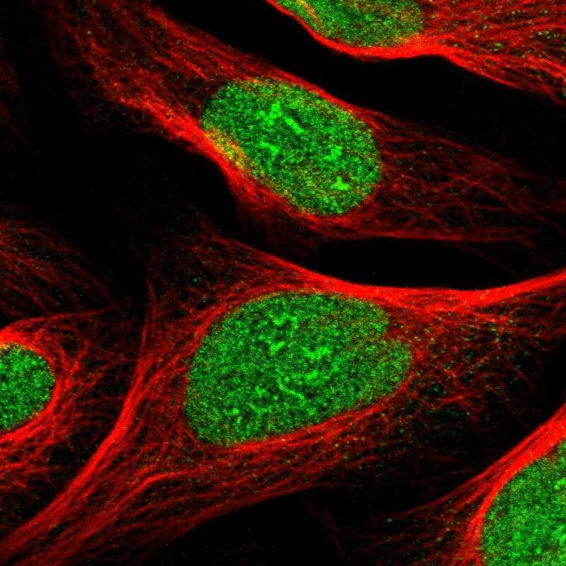 ZNF297B Antibody - BSA Free Immunocytochemistry/ Immunofluorescence: ZNF297B Antibody [NBP1-92621]