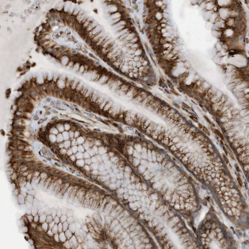 ZNF499 Antibody - BSA Free Immunohistochemistry-Paraffin: ZNF499 Antibody [NBP1-92627]