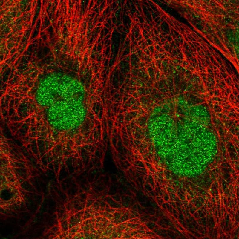 ZNF509 Antibody - BSA Free Immunocytochemistry/ Immunofluorescence: ZNF509 Antibody [NBP1-92628]