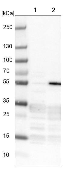 ZNF509 Antibody - BSA Free Western Blot: ZNF509 Antibody - BSA Free [NBP1-92628]