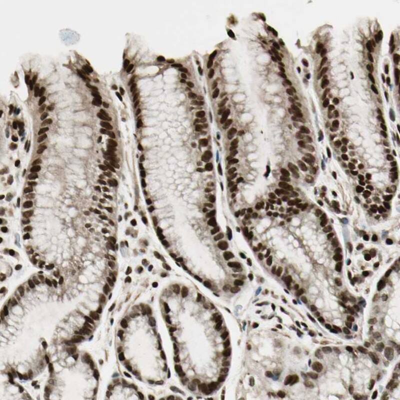ZNF537 Antibody - BSA Free Immunohistochemistry: ZNF537 Antibody - BSA Free [NBP1-92629]
