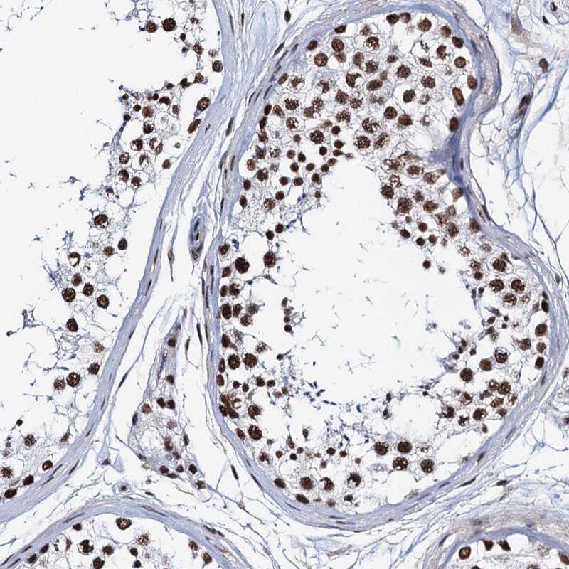 ZNF609 Antibody - BSA Free Immunohistochemistry-Paraffin: ZNF609 Antibody [NBP1-92633]