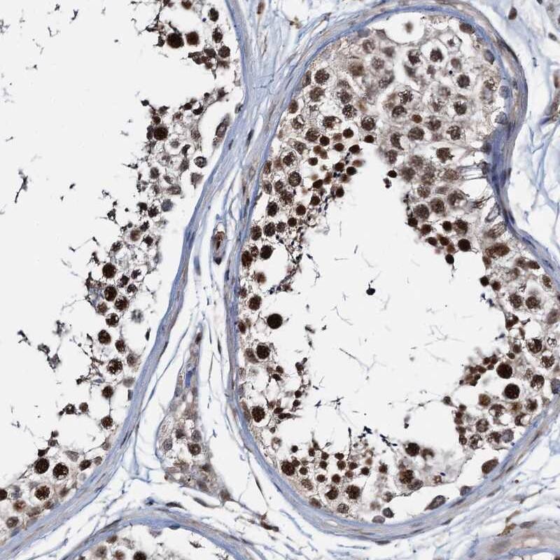 ZNF609 Antibody - BSA Free Immunohistochemistry-Paraffin: ZNF609 Antibody [NBP1-92634]