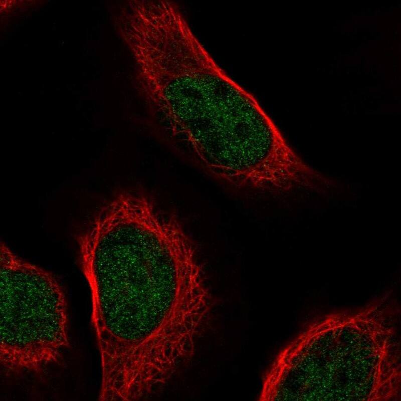 ZNF628 Antibody - BSA Free Immunocytochemistry/ Immunofluorescence: ZNF628 Antibody - BSA Free [NBP1-92638]