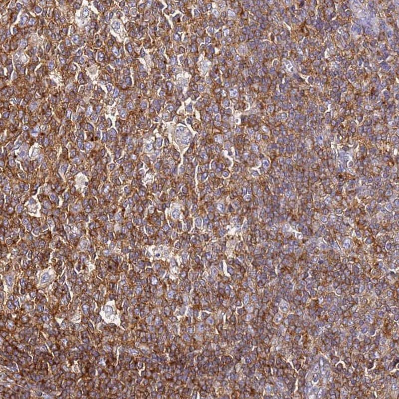 ZNF671 Antibody - BSA Free Immunohistochemistry: ZNF671 Antibody - BSA Free [NBP1-92641]