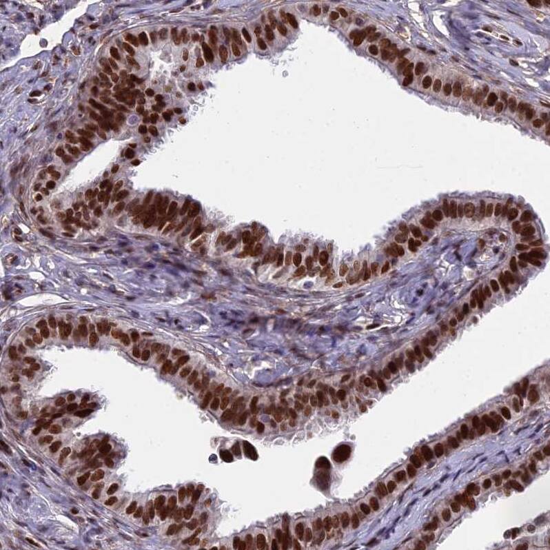 ZNF707 Antibody - BSA Free Immunohistochemistry: ZNF707 Antibody - BSA Free [NBP1-92642]