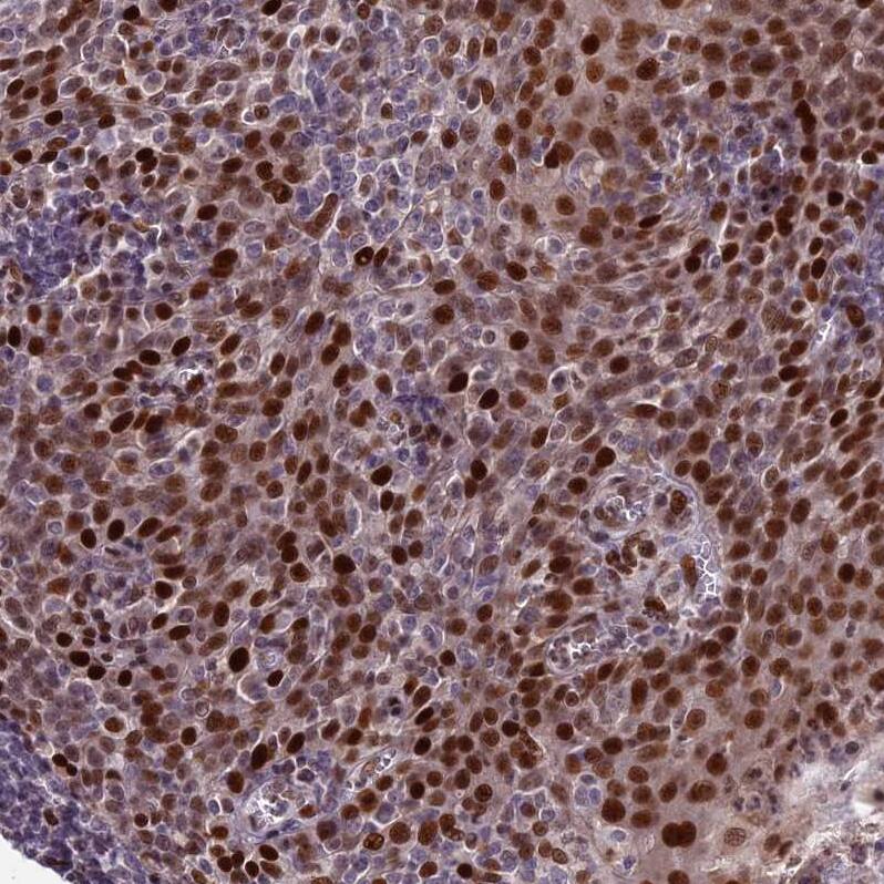 ZNF707 Antibody - BSA Free Immunohistochemistry: ZNF707 Antibody - BSA Free [NBP1-92642]
