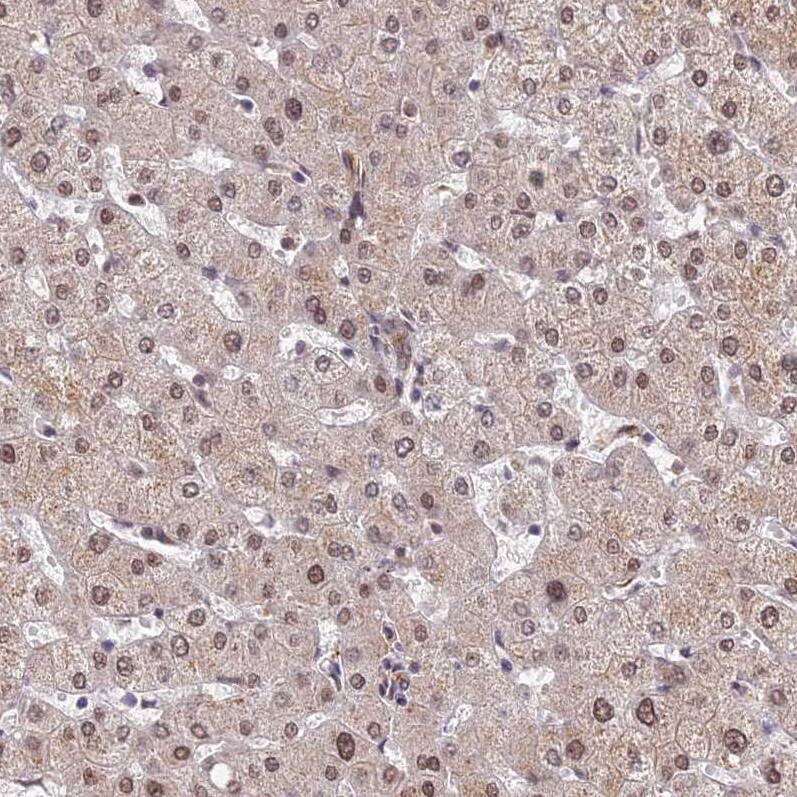 ZNF85 Antibody - BSA Free Immunohistochemistry: ZNF85 Antibody - BSA Free [NBP1-92645]