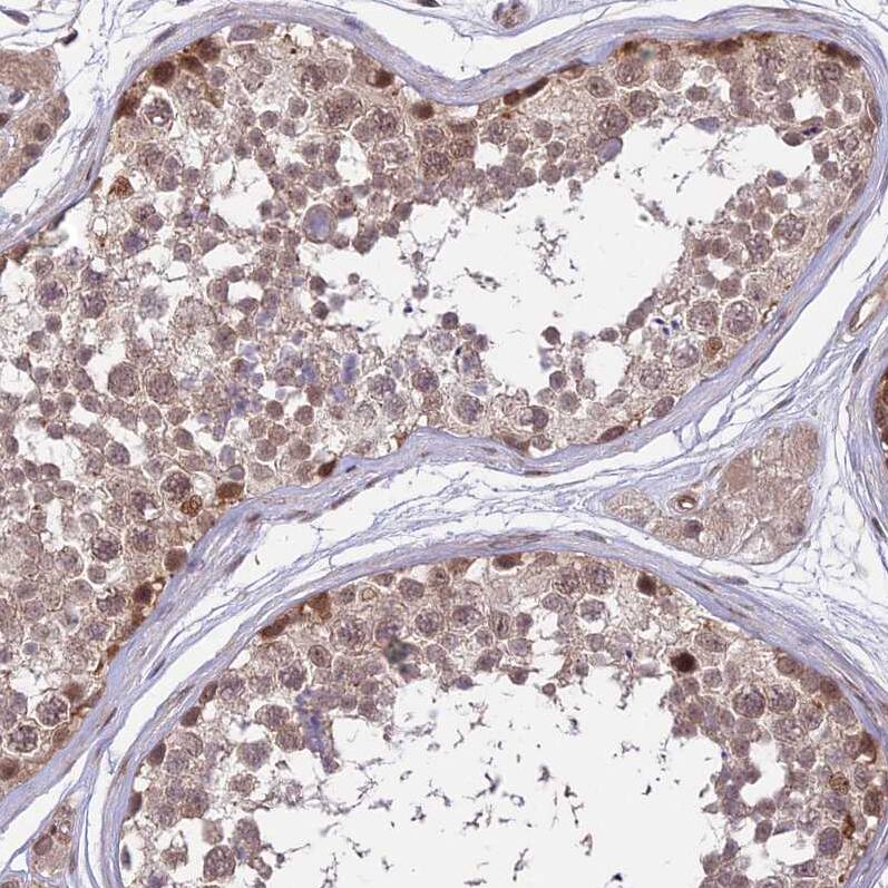 ZNF85 Antibody - BSA Free Immunohistochemistry: ZNF85 Antibody - BSA Free [NBP1-92645]