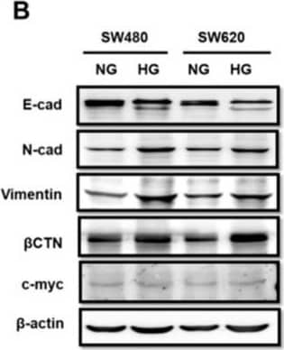 Vimentin Antibody (2D1)
