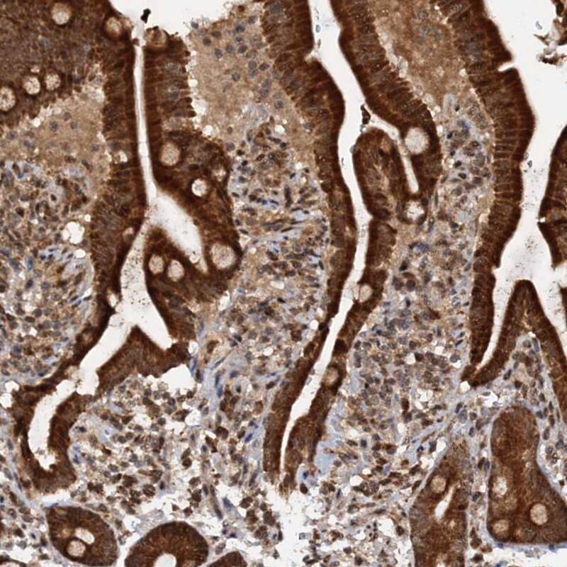 REP15 Antibody - BSA Free Immunohistochemistry: REP15 Antibody - BSA Free [NBP1-93441]