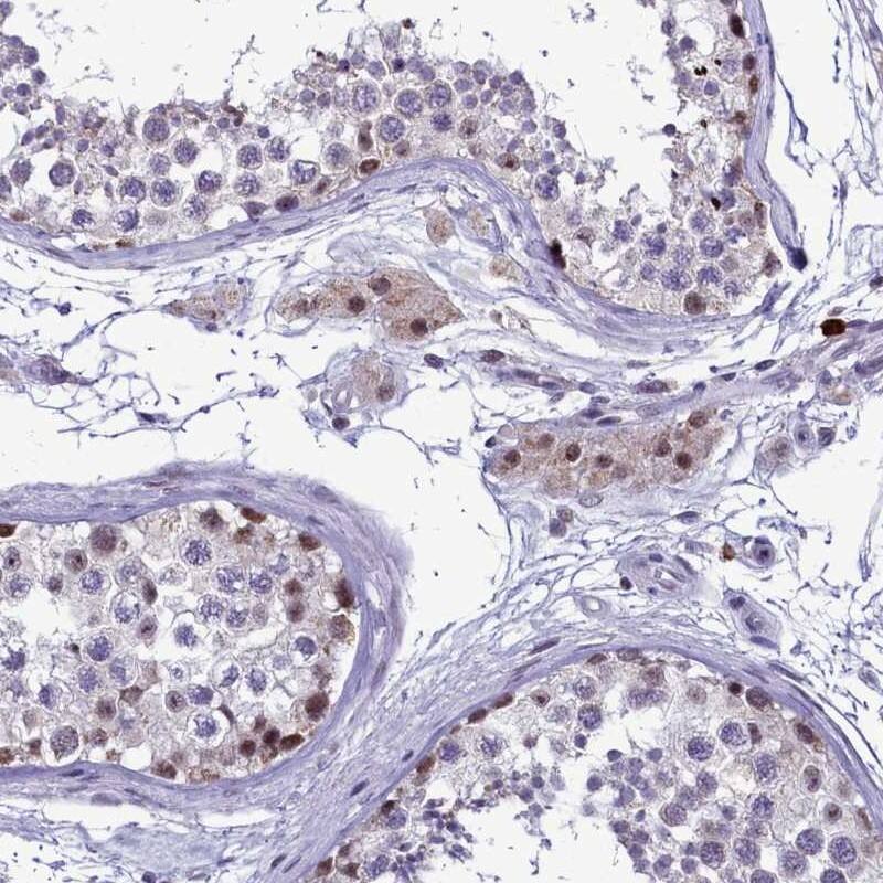 POM121L2 Antibody - BSA Free Immunohistochemistry: POM121L2 Antibody - BSA Free [NBP1-93443]