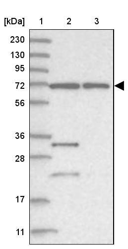 ZNF674 Antibody - BSA Free Western Blot: ZNF674 Antibody - BSA Free [NBP1-93452]