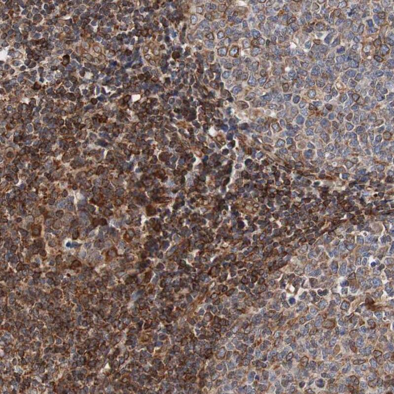 TMEM109 Antibody - BSA Free Immunohistochemistry: TMEM109 Antibody - BSA Free [NBP1-93462]