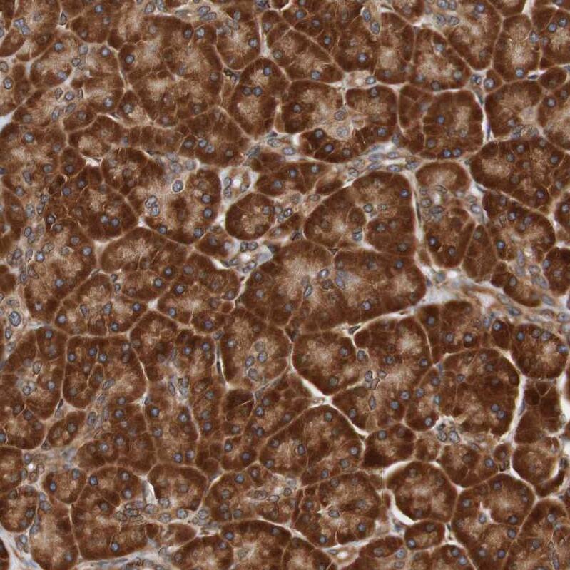 TMEM109 Antibody - BSA Free Immunohistochemistry: TMEM109 Antibody - BSA Free [NBP1-93462]