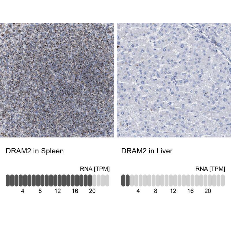 DRAM2 Antibody - BSA Free Immunohistochemistry: DRAM2 Antibody - BSA Free [NBP1-93463]