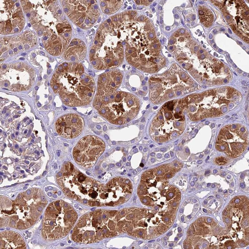 CILP2 Antibody - BSA Free Immunohistochemistry: CILP2 Antibody - BSA Free [NBP1-93469]