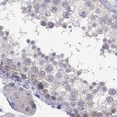 C16orf89 Antibody - BSA Free Immunohistochemistry-Paraffin: C16orf89 Antibody [NBP1-93470]