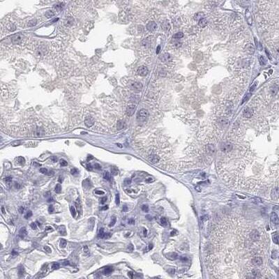 C16orf89 Antibody - BSA Free Immunohistochemistry-Paraffin: C16orf89 Antibody [NBP1-93470]