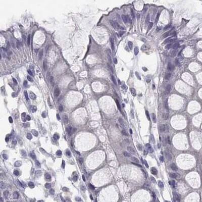 C16orf89 Antibody - BSA Free Immunohistochemistry-Paraffin: C16orf89 Antibody [NBP1-93470]