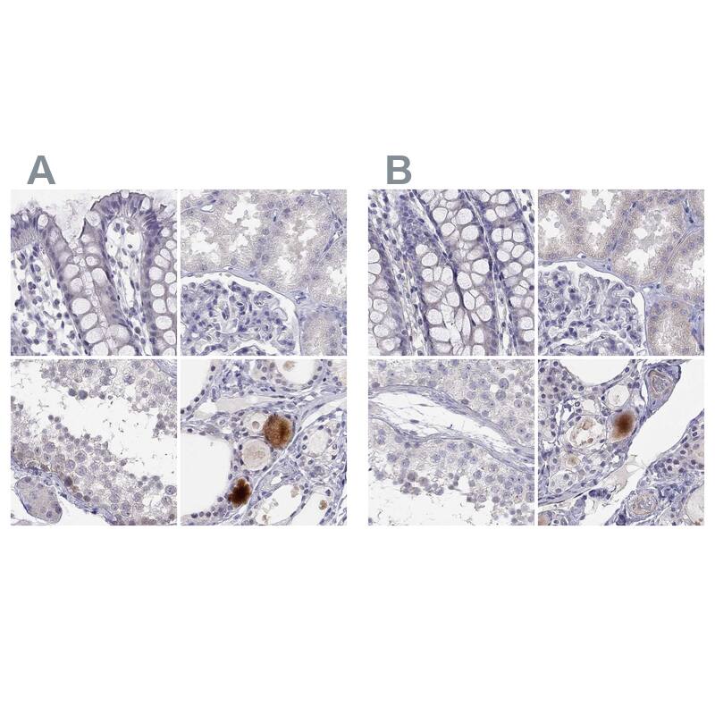 C16orf89 Antibody - BSA Free Immunohistochemistry-Paraffin: C16orf89 Antibody [NBP1-93470]