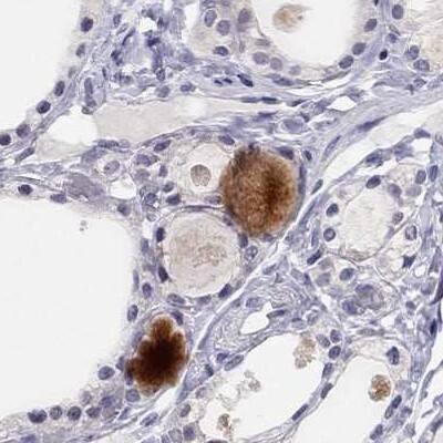 C16orf89 Antibody - BSA Free Immunohistochemistry: C16orf89 Antibody - BSA Free [NBP1-93470]