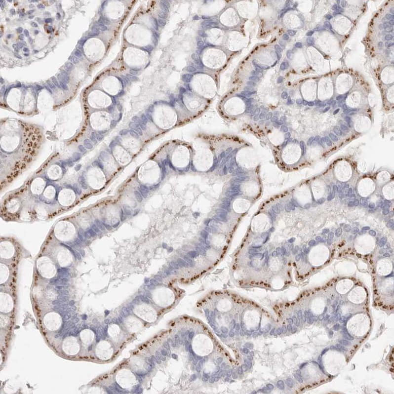 FAM185A Antibody - BSA Free Immunohistochemistry: FAM185A Antibody - BSA Free [NBP1-93479]