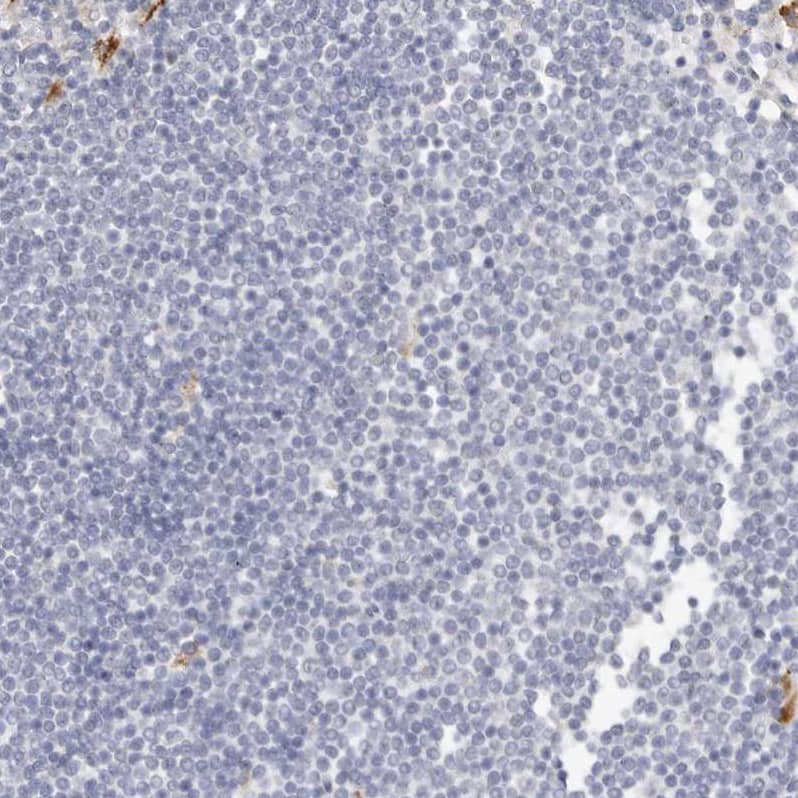FAM185A Antibody - BSA Free Immunohistochemistry: FAM185A Antibody - BSA Free [NBP1-93479]