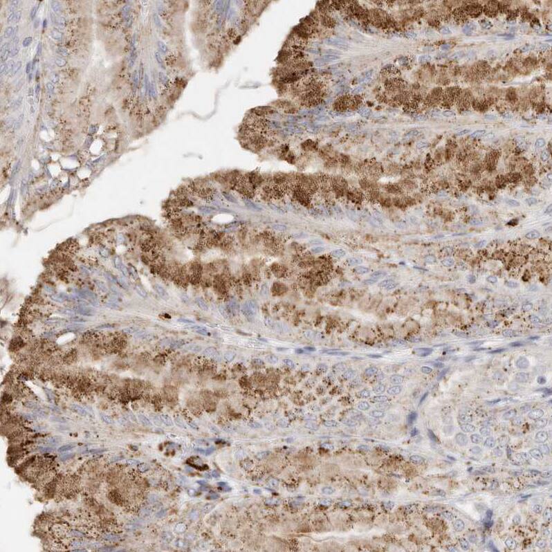 FAM185A Antibody - BSA Free Immunohistochemistry: FAM185A Antibody - BSA Free [NBP1-93479]