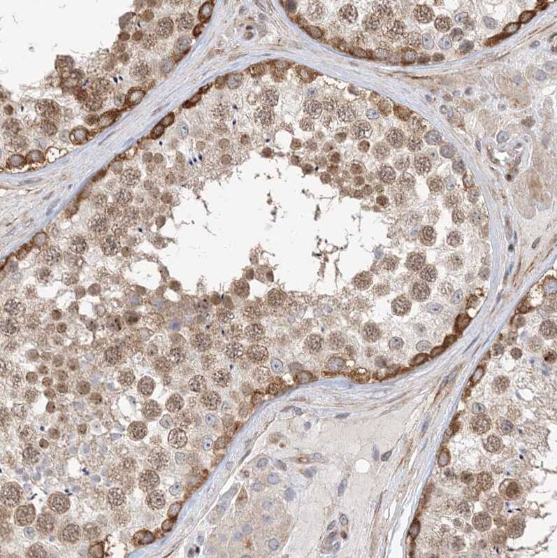 TYSND1 Antibody - BSA Free Immunohistochemistry: TYSND1 Antibody - BSA Free [NBP1-93484]