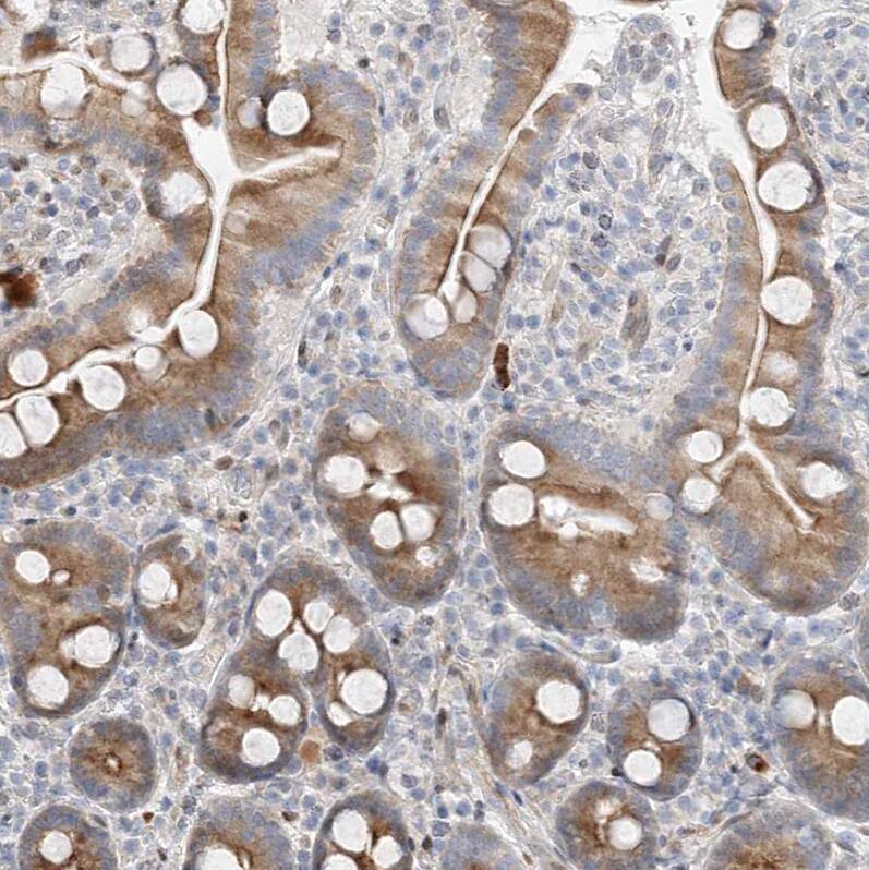 TYSND1 Antibody - BSA Free Immunohistochemistry: TYSND1 Antibody - BSA Free [NBP1-93484]