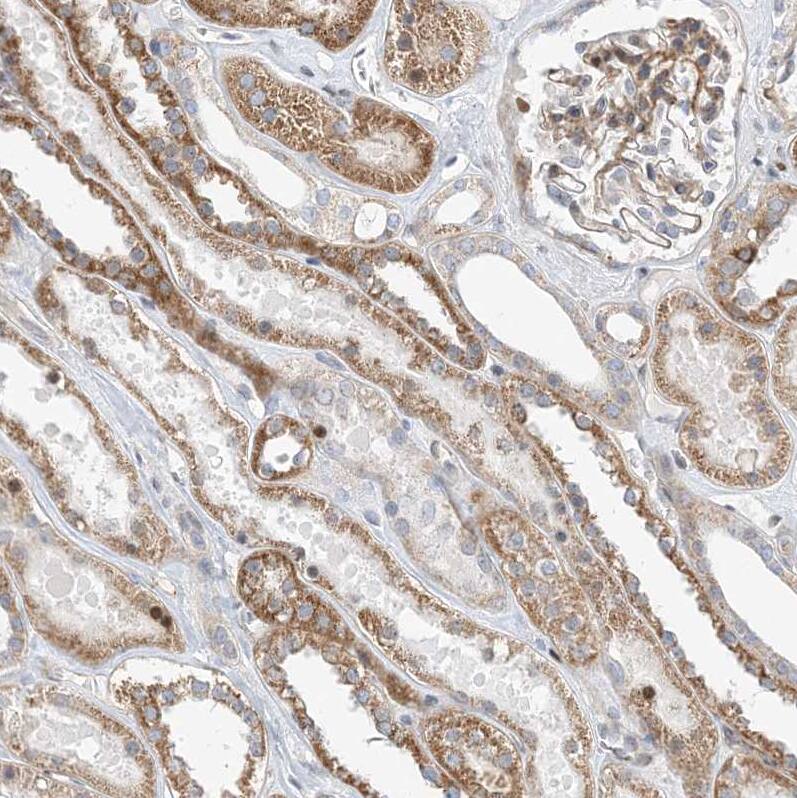 TYSND1 Antibody - BSA Free Immunohistochemistry: TYSND1 Antibody - BSA Free [NBP1-93484]