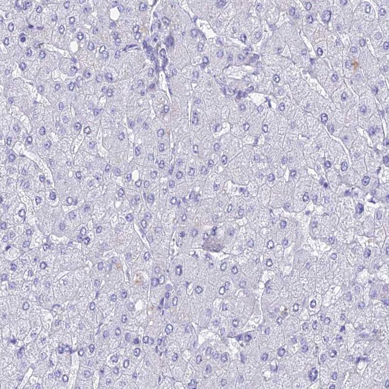 TMEM161B Antibody - BSA Free Immunohistochemistry: TMEM161B Antibody - BSA Free [NBP1-93488]